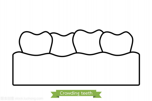 种牙和带假牙套的区别在哪,假牙戴不上怎么办